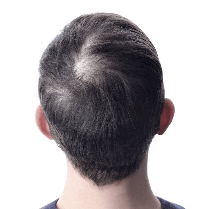 Hair growth and anti-hair loss scalp repair essence